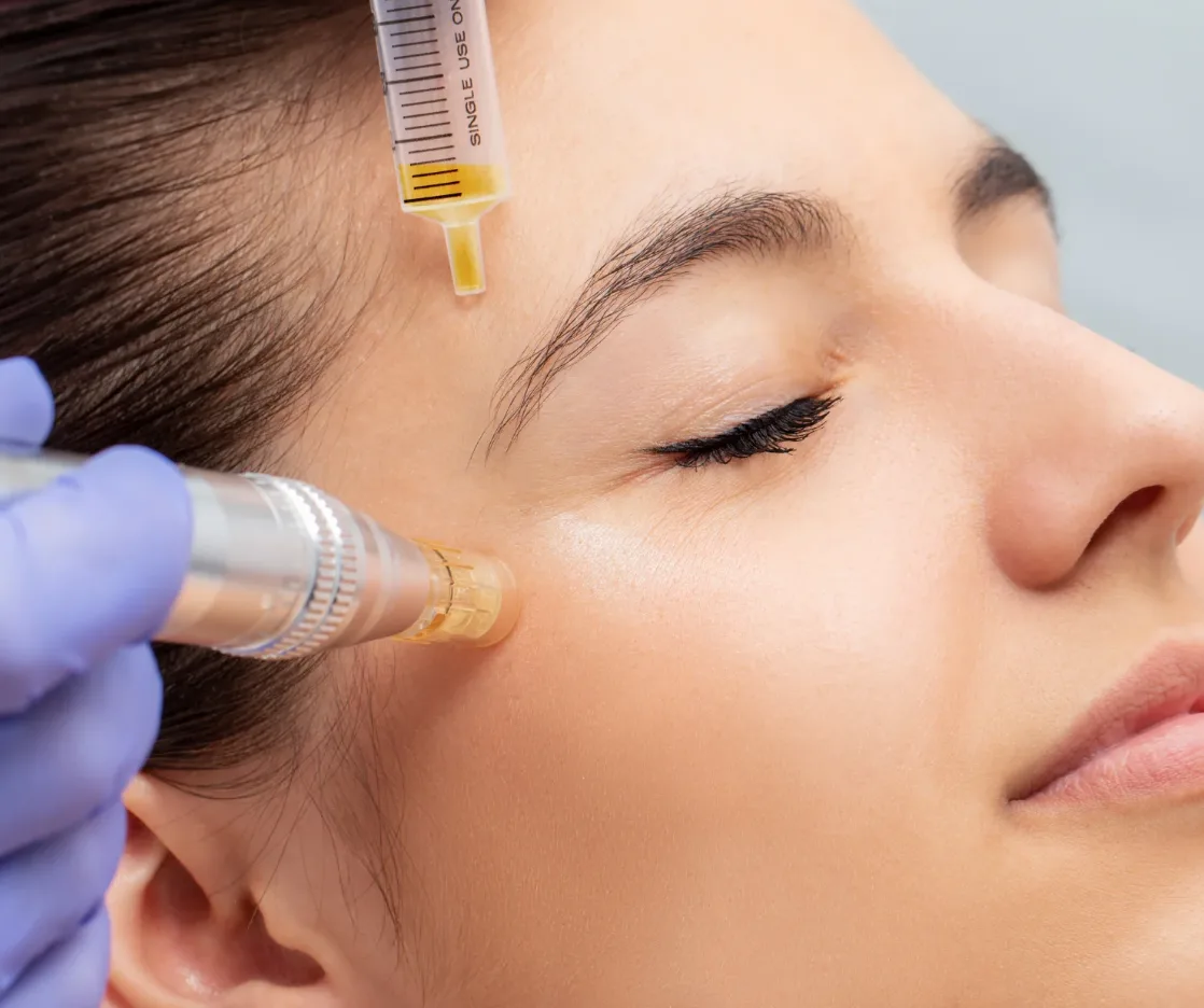 Rejuvaline Medspa Microneedling / PRP Rejuvaline Medspa Microneedling / PRP